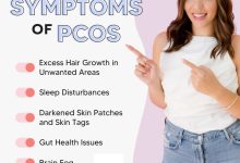 PCOS symptoms